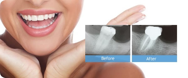 Healthy Smile Healthy Smile